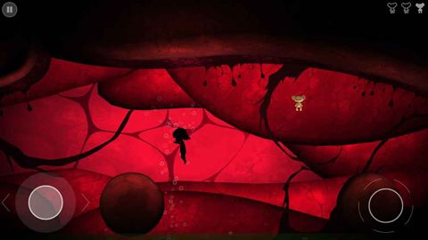 噩梦：疟疾游戏安卓ios噩梦：疟疾游戏安卓ios版官方免费下载版官方免费下载